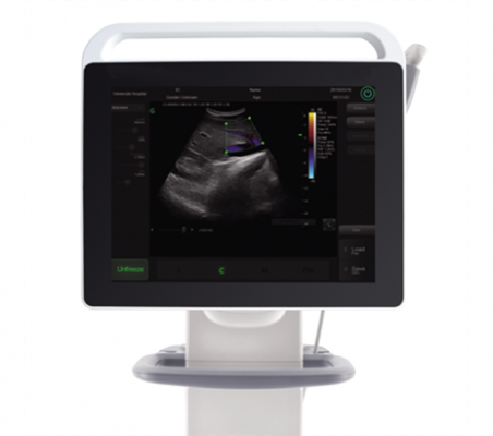 彩色多普勒超聲診斷系統