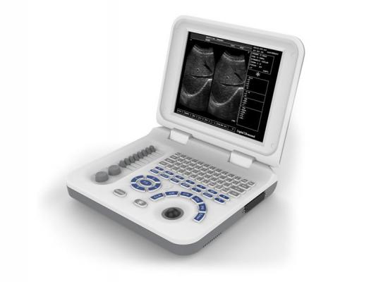 XF30數字B型超聲診斷儀（筆記本式）