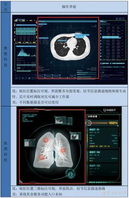 肺結節CT影像輔助檢測軟件Yitu_AICare_CT_Chest