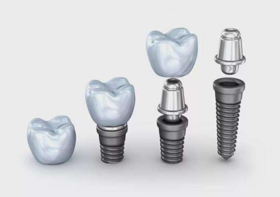 牙科種植系統(tǒng)Dental Implant System